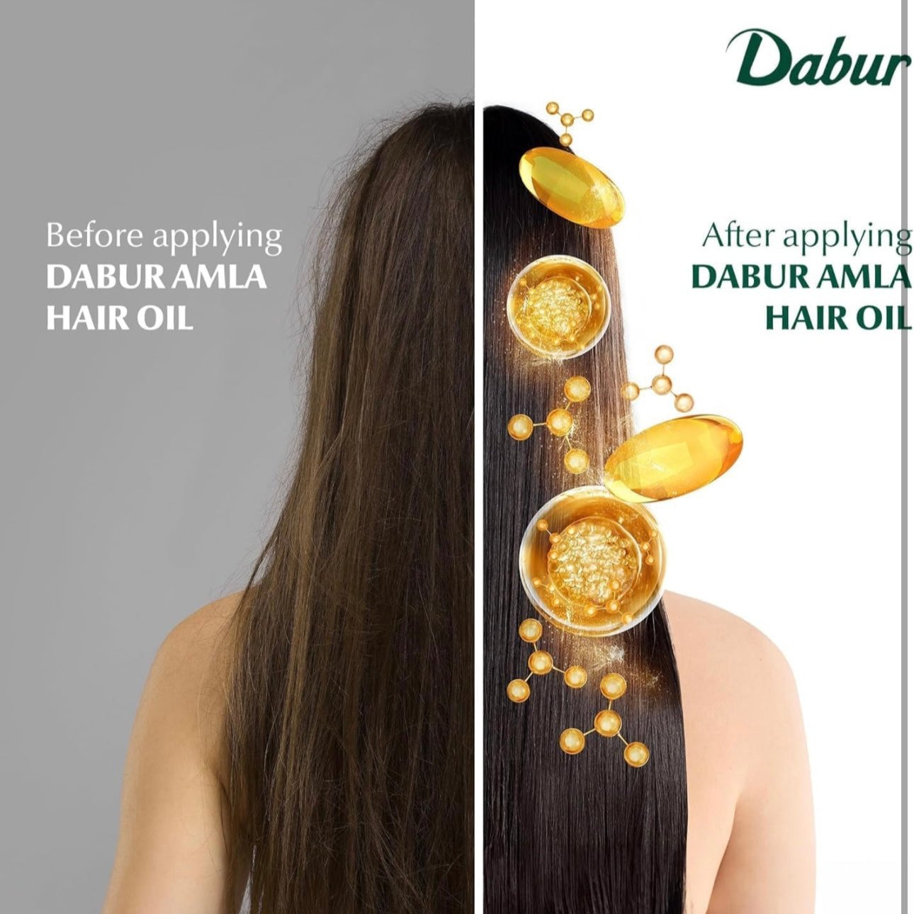 Dabur Amla Hair Oil - Nourishing Indian Oil for Men & Women, for Healthy, Moisturized Hair and Scalp (300ml)