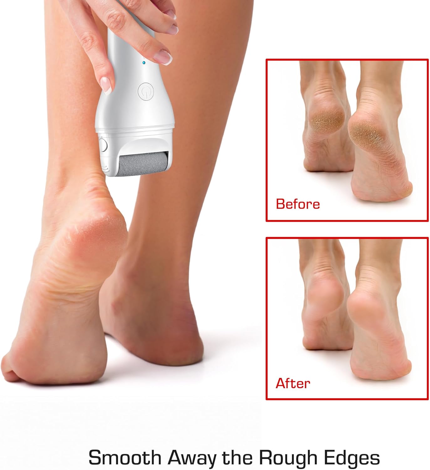 Cordless Foot Callus Remover  Easy & Portable Long and Curved Roller Head Stone